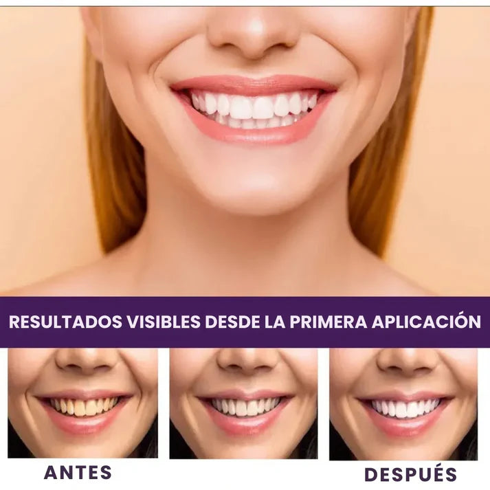 Blanqueador Dental Morado Elite- Efecto Inmediato